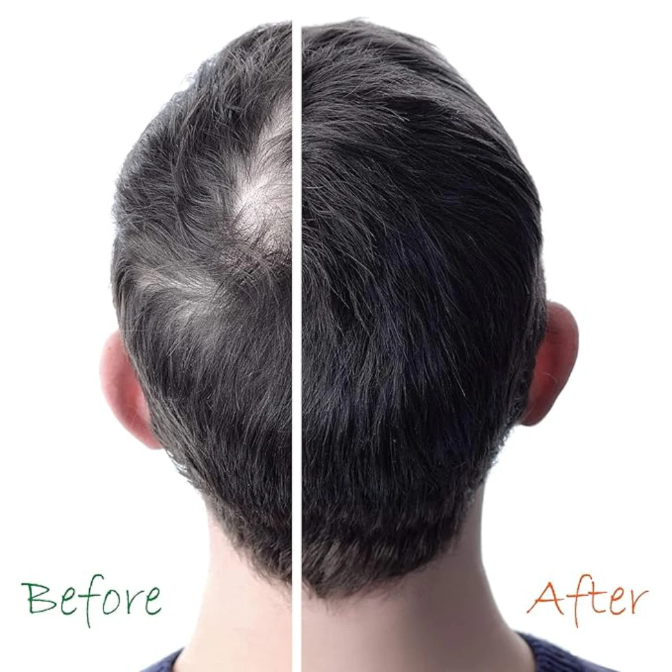 Original Hair Energizer Hair Booster 6oz | Vitamin B5 Repair for Damaged Hair - Image 3